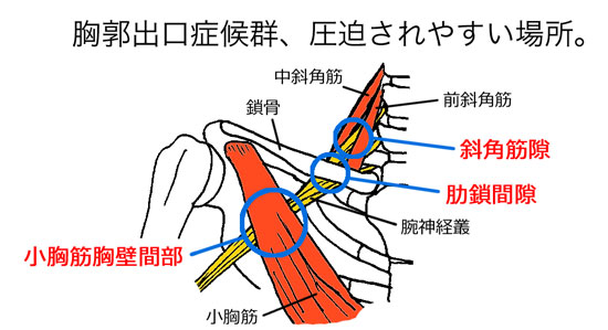 東御,整体,頭痛,肩こり,腰痛,指圧,経絡,らせん,筋膜,マッサージ,胸郭出口症候群